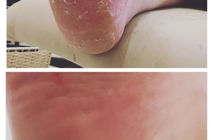 かかとツルツル 角質除去  オールハンドケア 新小岩